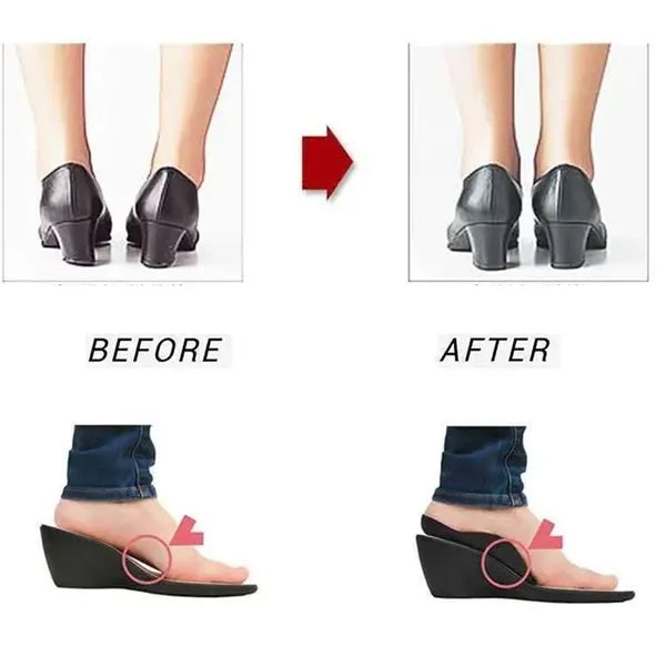 Arch support pad orthopedic insole
