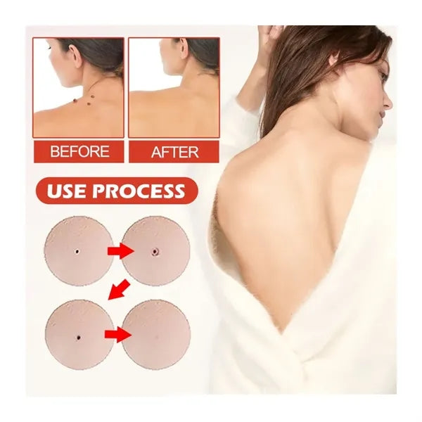 Pimple Patches for Face