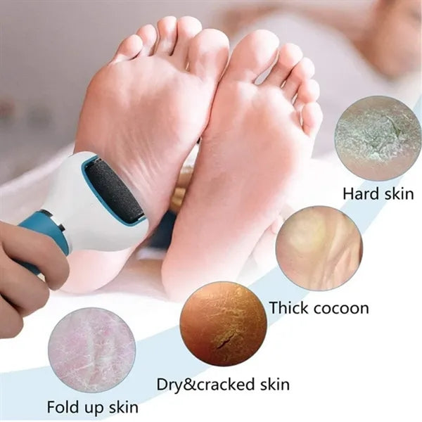 Electric Foot Exfoliator Roller